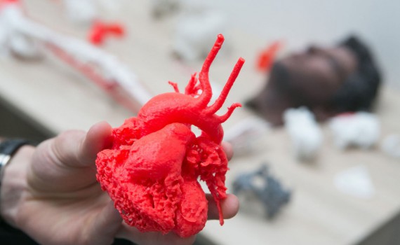 Model srdca z 3D tlačiarne.